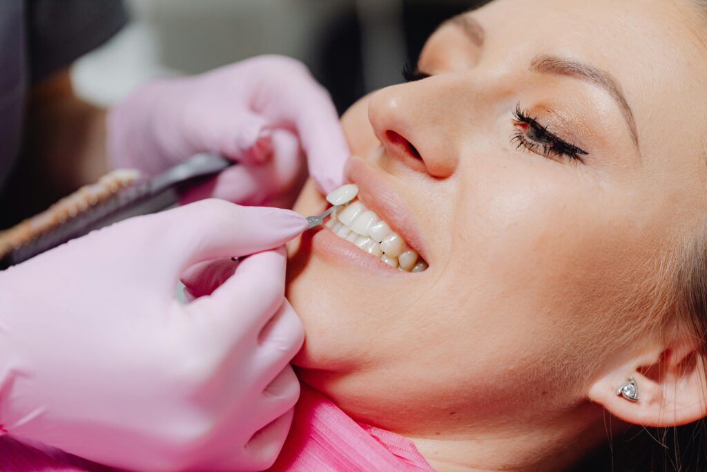 Cambridge dental patients desire teeth whitening