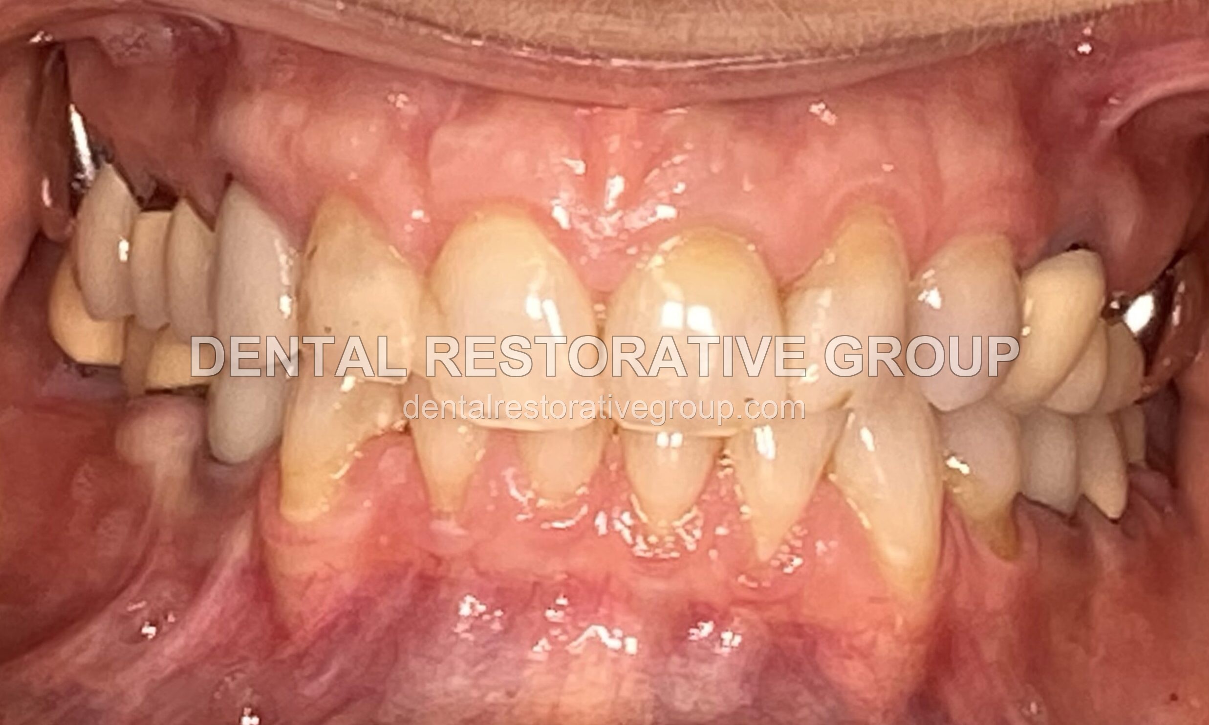 Complex Case Solutions before treatment