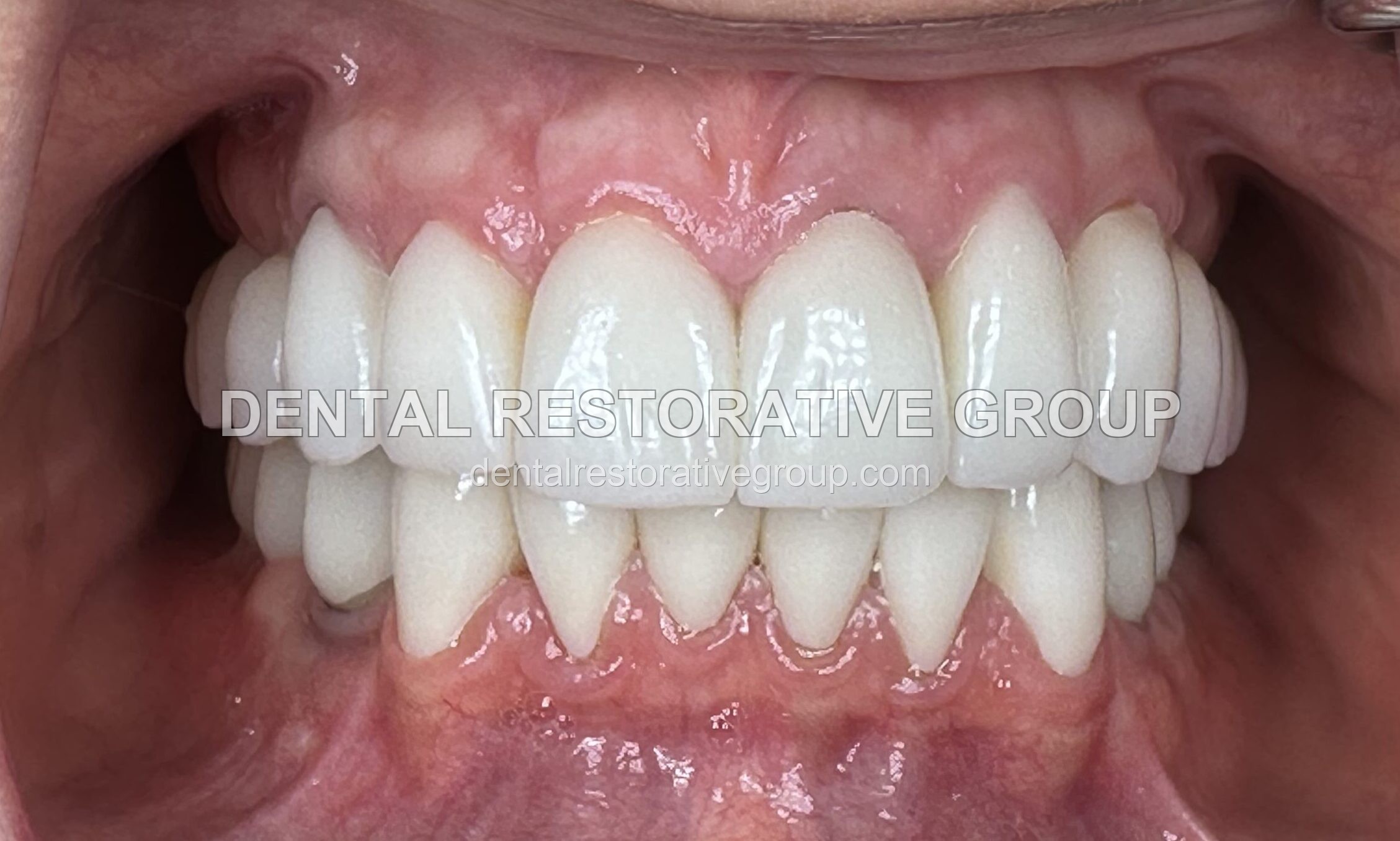 Complex Case Solutions after treatment