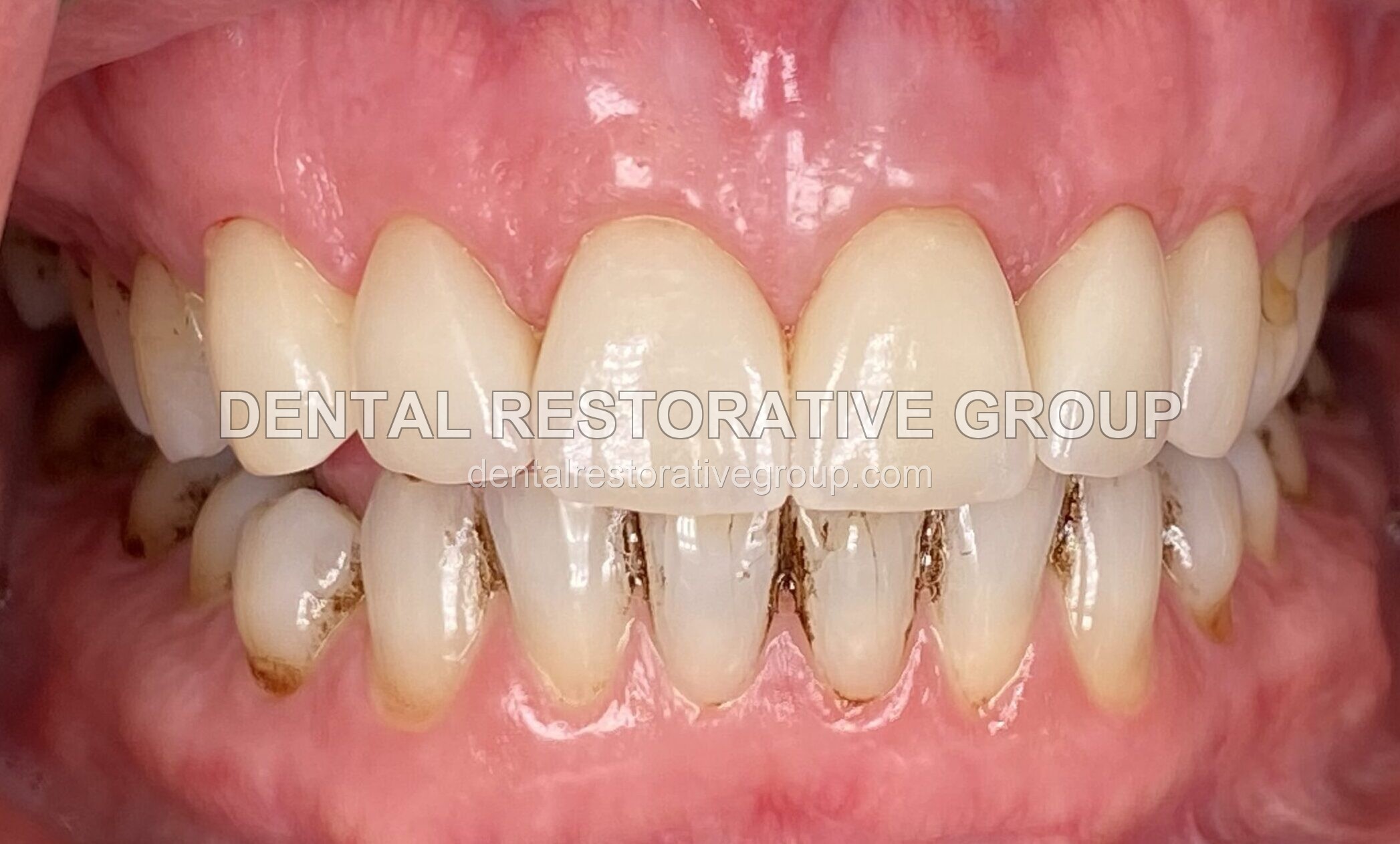 Cosmetic Dentistry after treatment