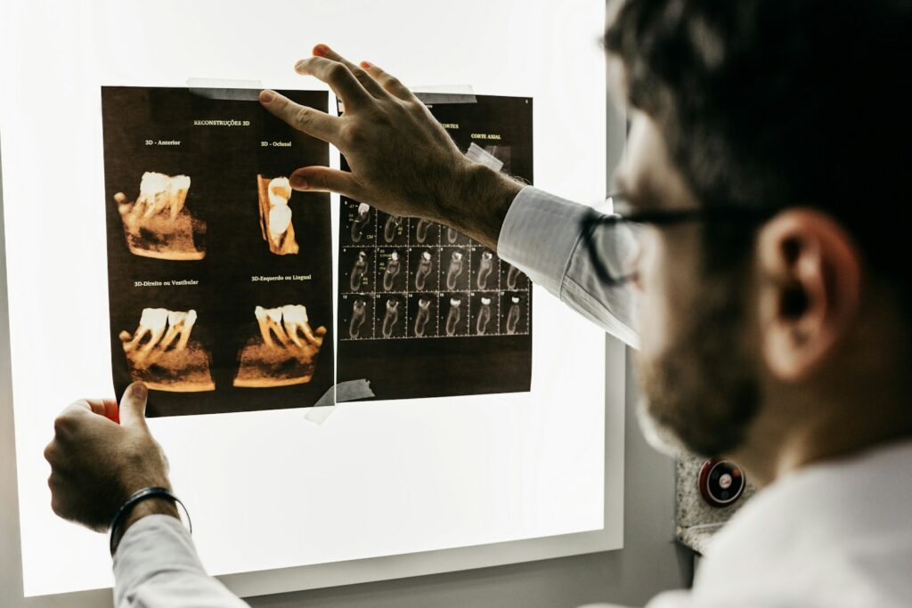 Dentist reviewing a dental X-ray while planning full-mouth reconstruction