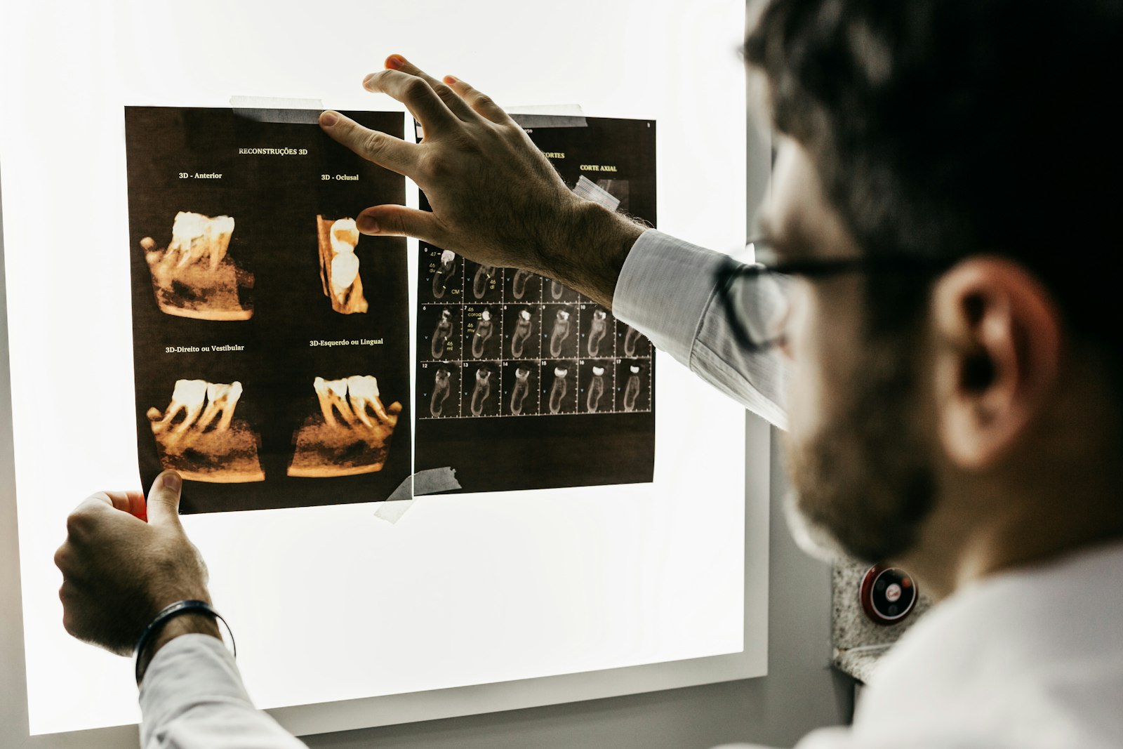 Dentist reviewing a dental X-ray while planning full-mouth reconstruction