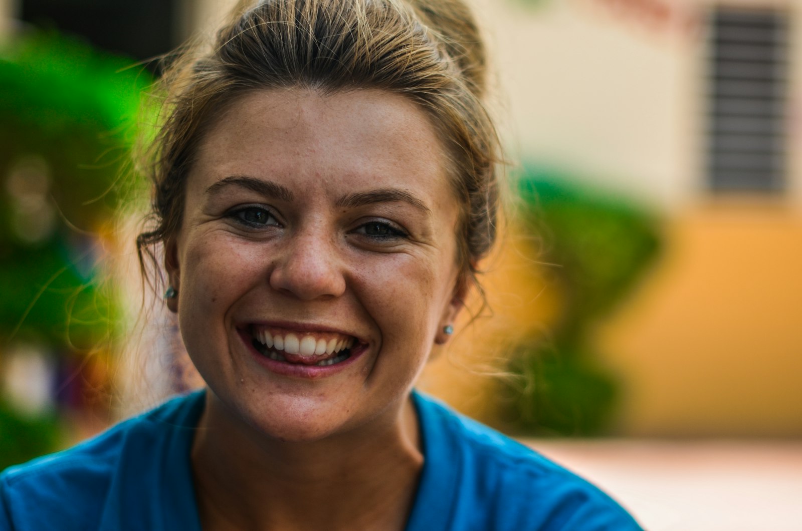 Close-up of a natural, even smile after front-tooth restorative dentistry