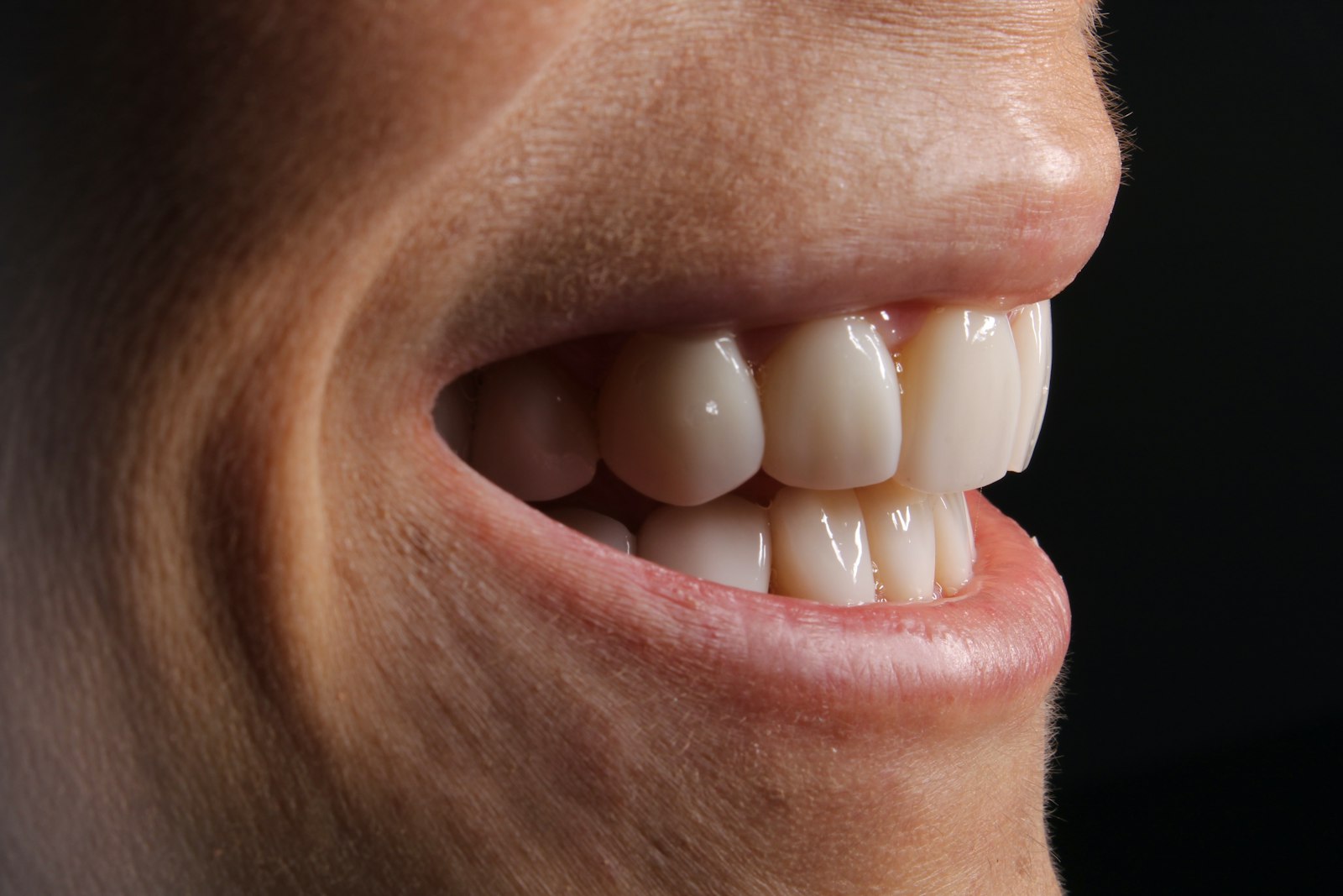 Close-up of front teeth relevant to crowns and restorations for musicians
