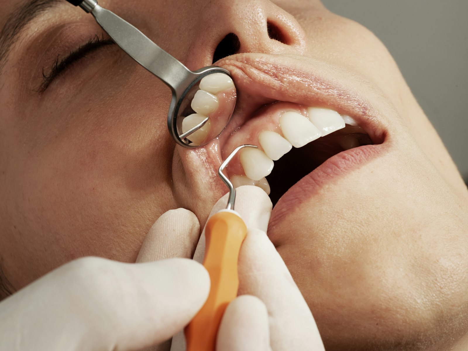 Dentist examining tooth enamel during a checkup in Cambridge MA