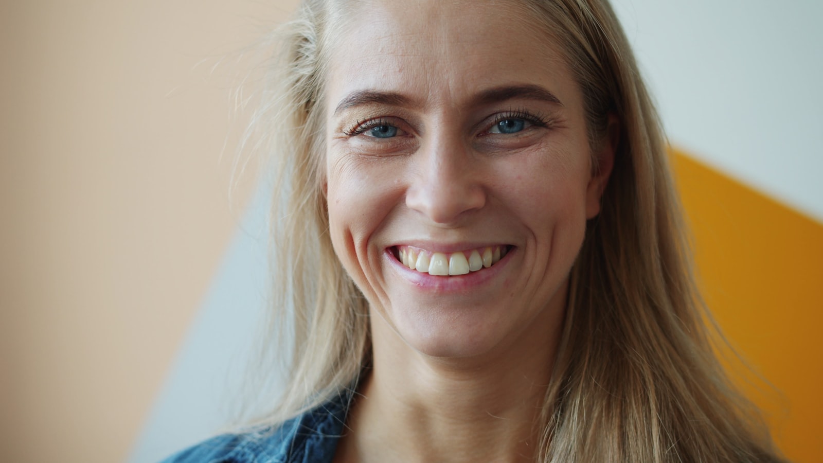 Temporary tooth gem on a natural smile in Boston and Cambridge MA
