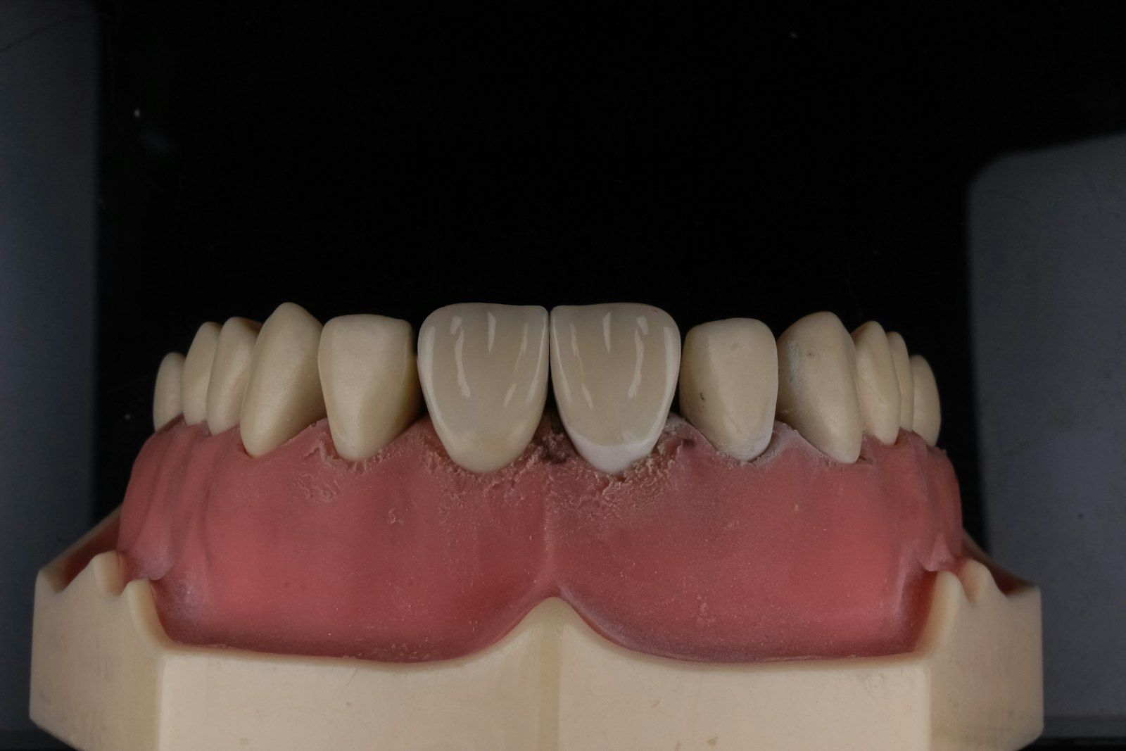 Model showing implant-supported full-arch teeth in Cambridge MA