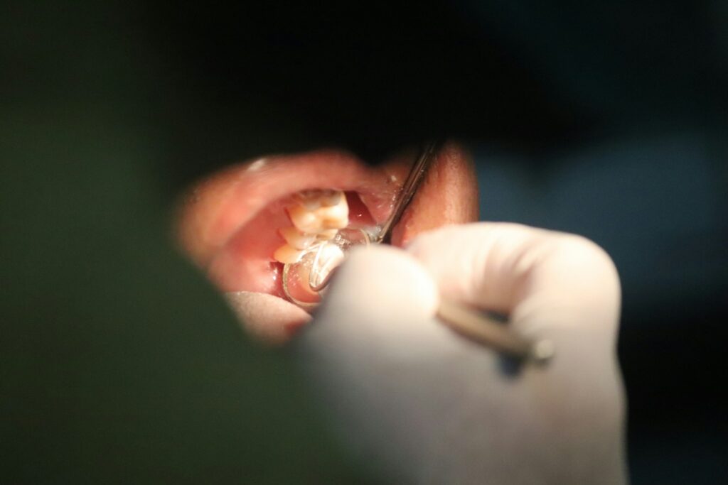 Emergency dental care for a cracked or knocked-out tooth in Belmont MA