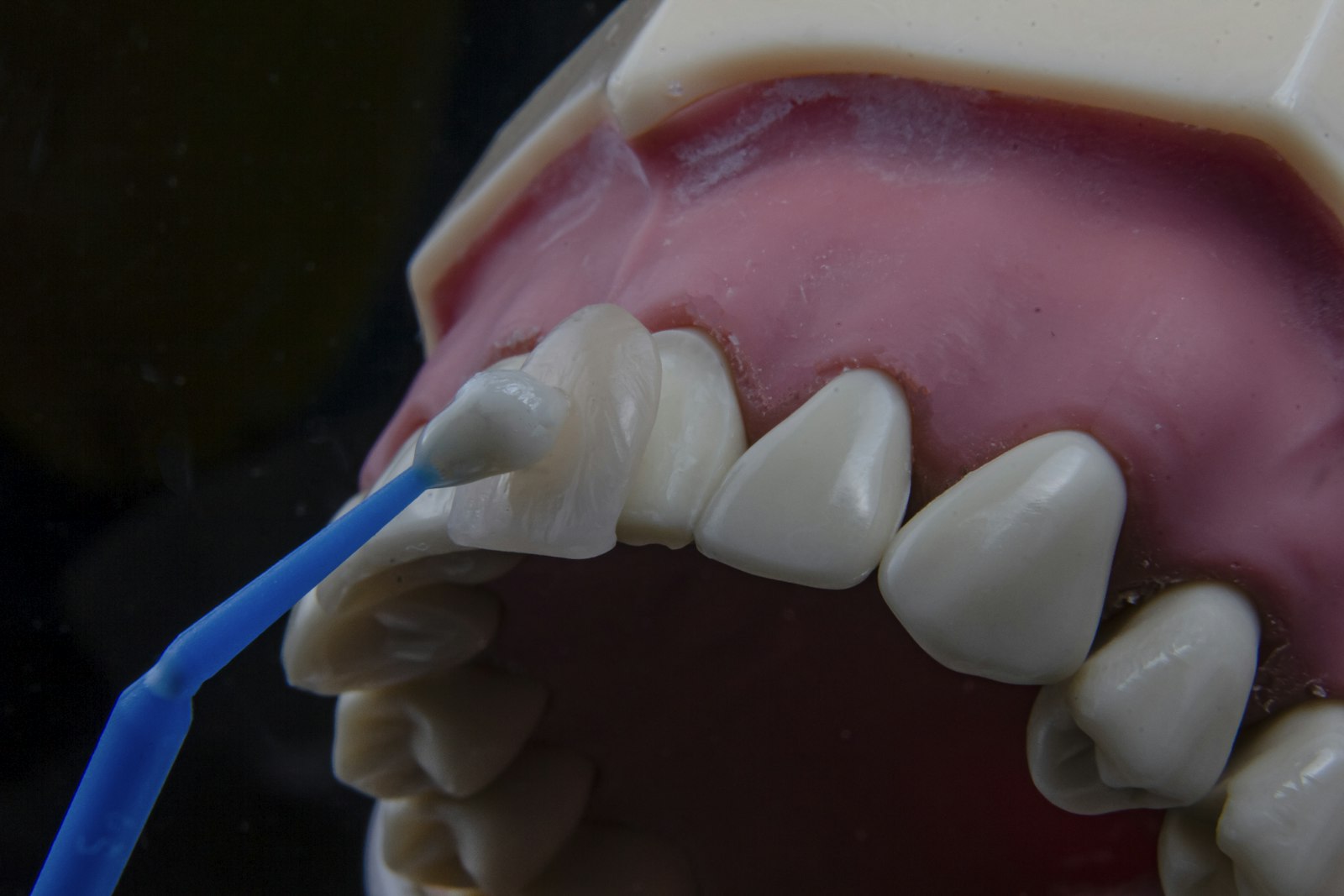 The contact and contour between teeth that can direct food into one spot