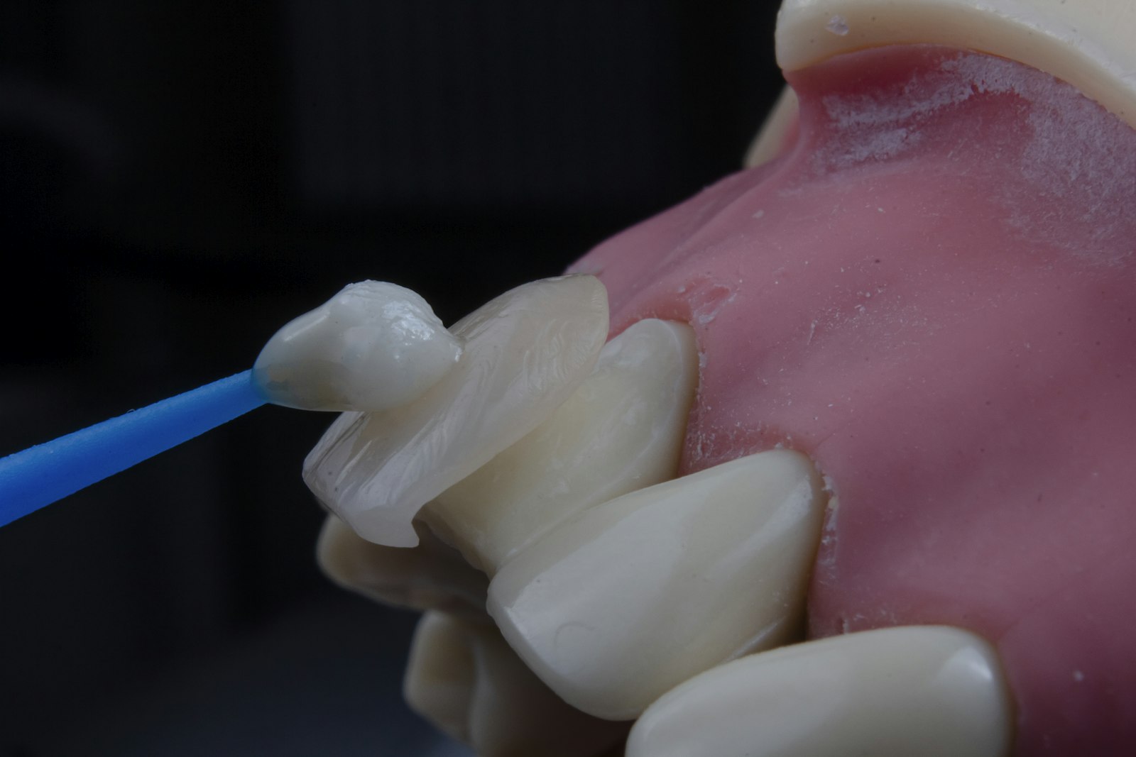 Flossing may clean a food trap but doesn't explain why food is directed there