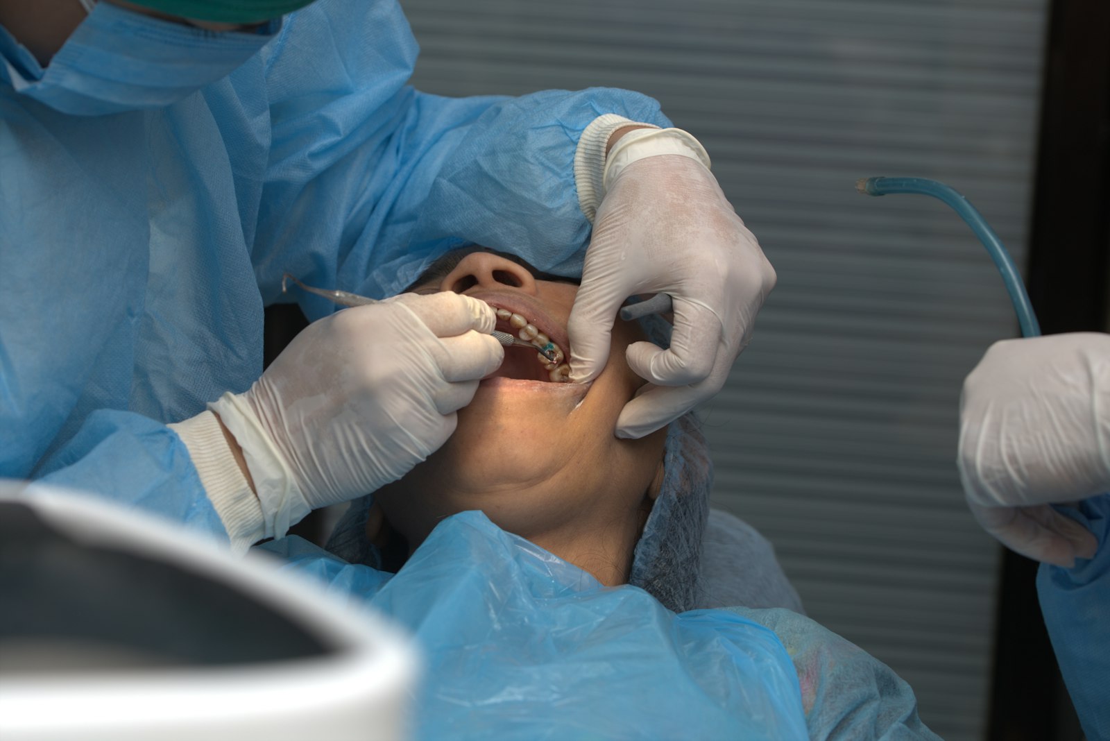 Dentist evaluating gum recession during an exam in Belmont MA