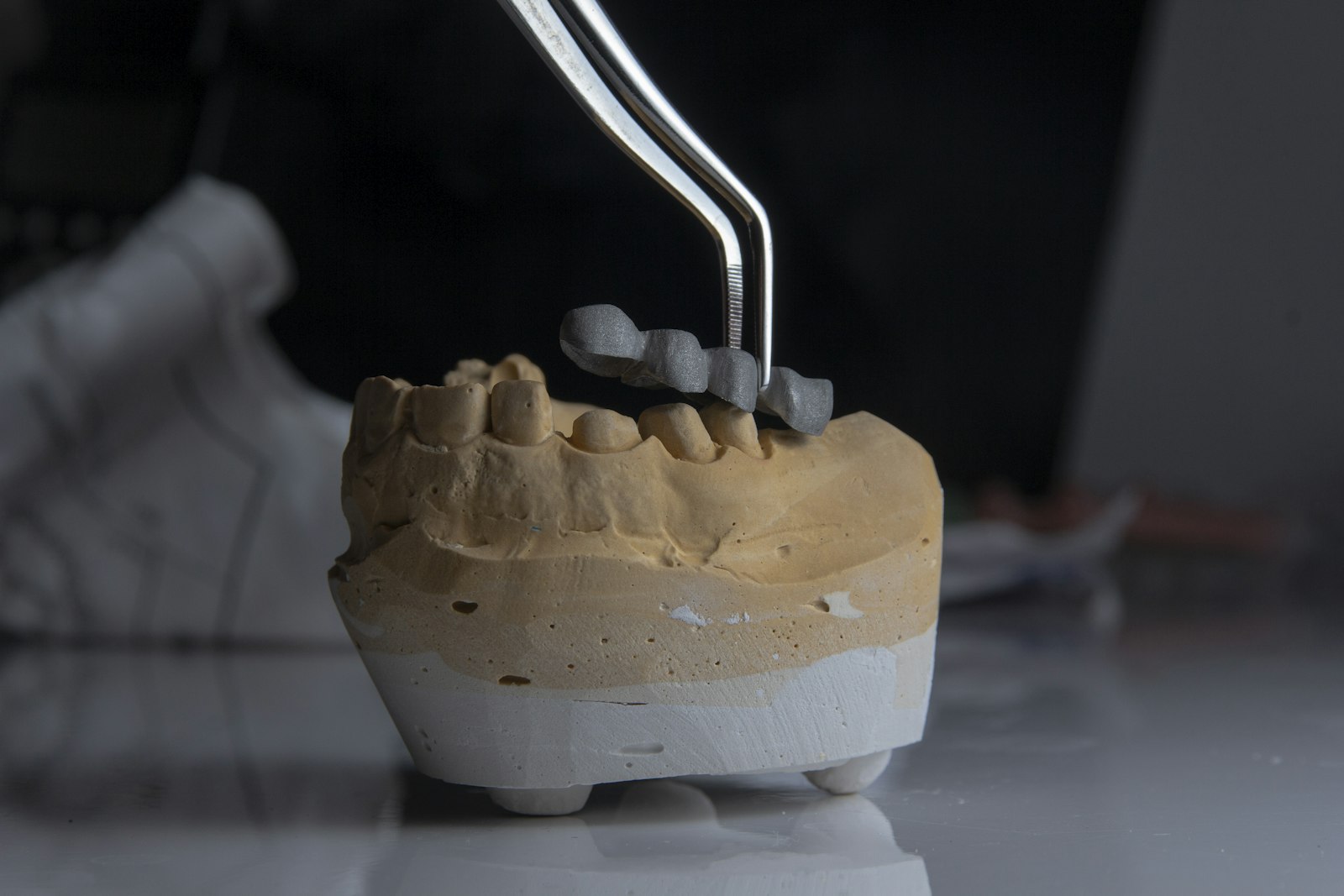 Model showing that a dental implant is a system of parts, not one tooth