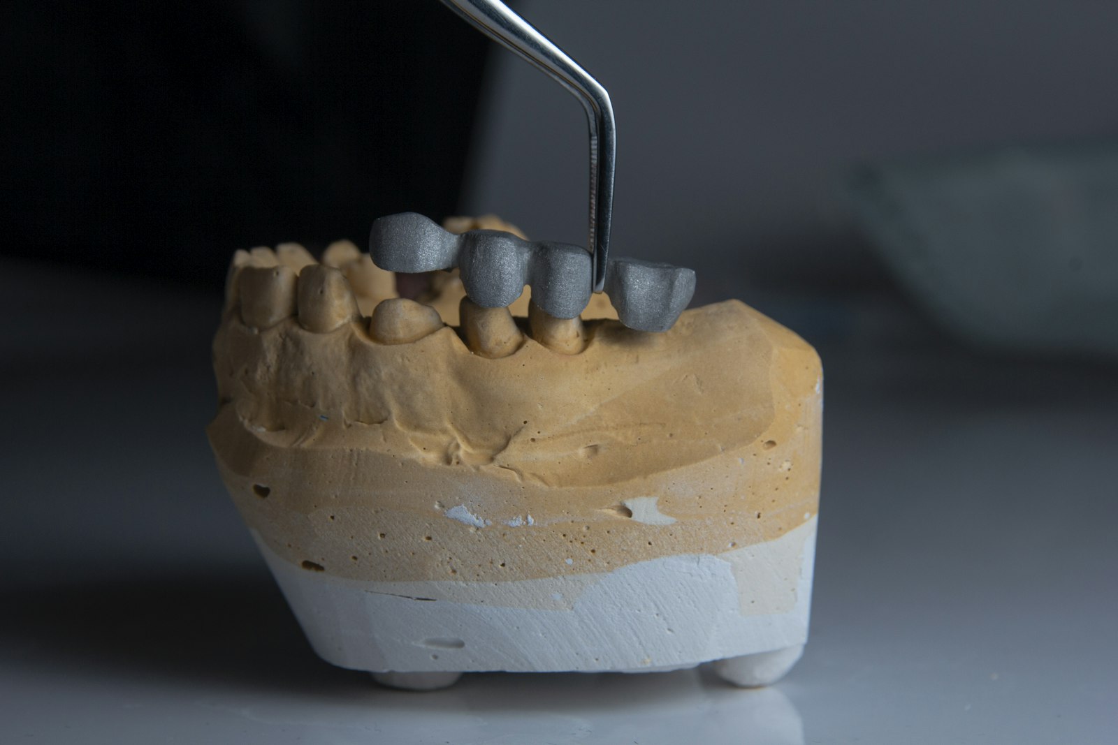 A tooth model illustrating repair options from filling to crown in Belmont MA