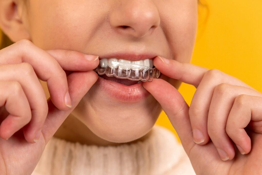 Person placing a custom nightguard to protect against teeth grinding in Belmont MA