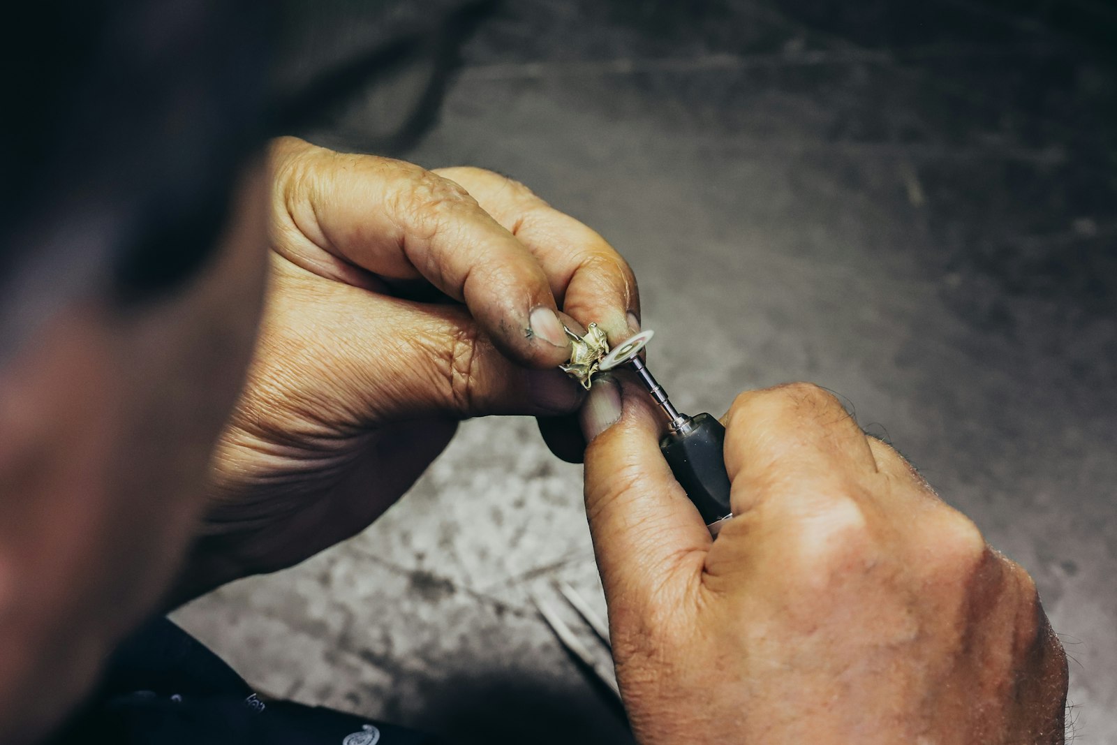 Crafting a provisional restoration during complex dental treatment in Belmont MA