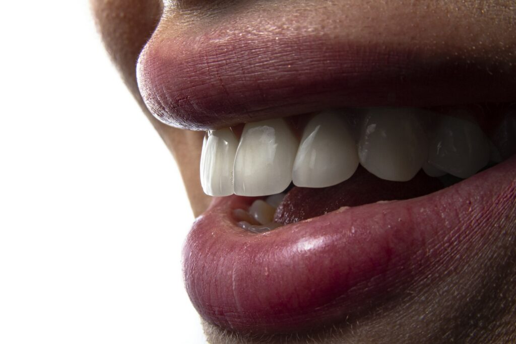 Healthy teeth and gums, the goal of treating gum disease early in Belmont MA