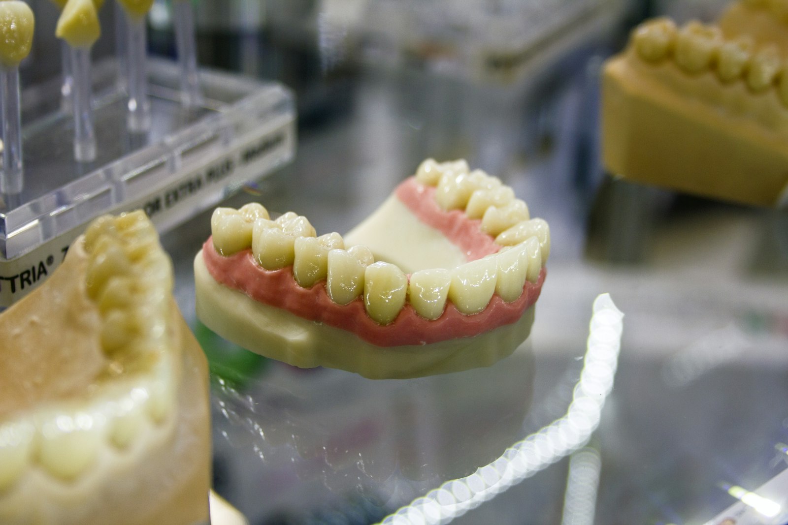 A dental crown model illustrating when an old restoration needs replacing in Belmont MA