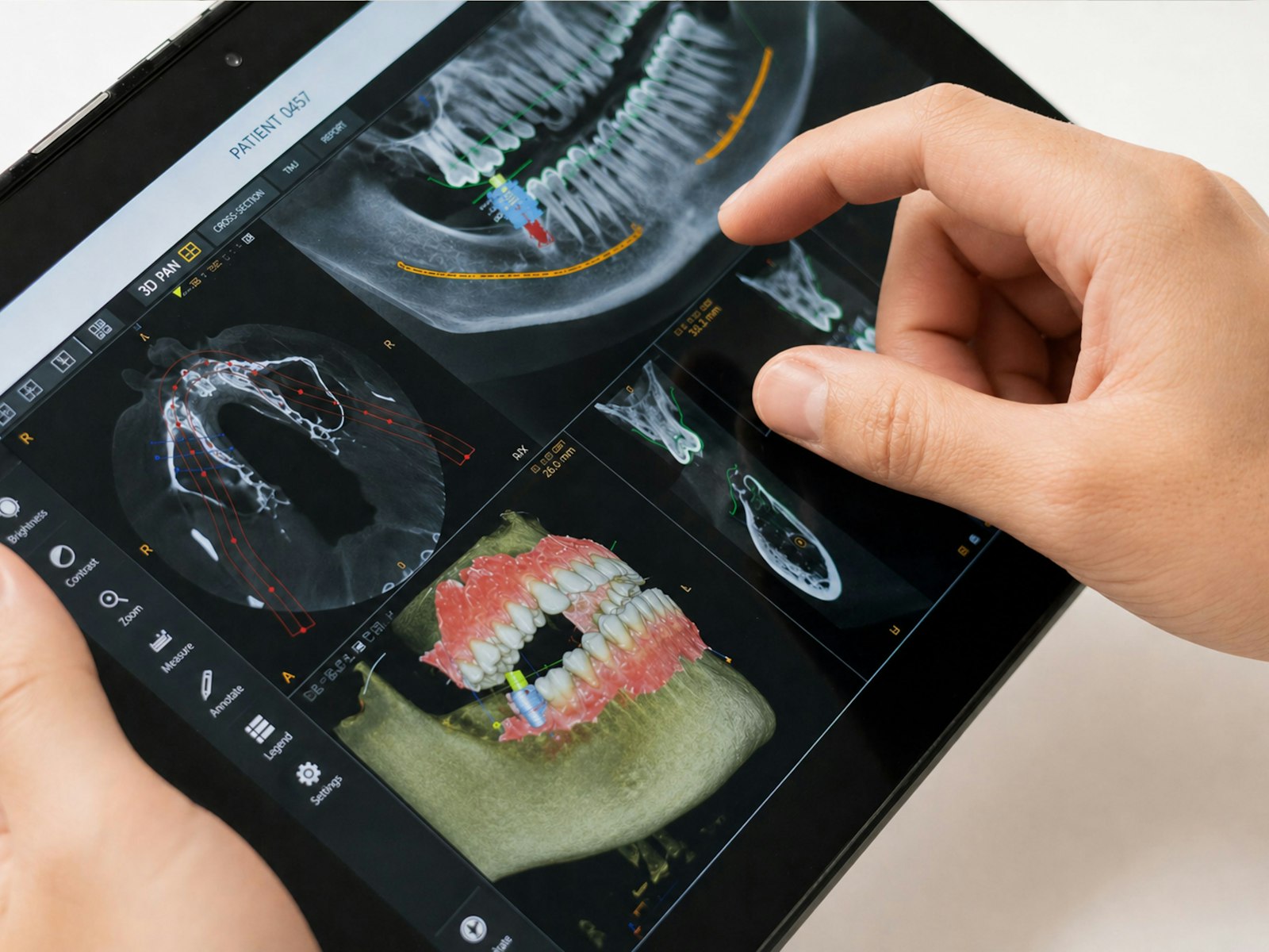 Reviewing an x-ray and tooth chart in Cambridge MA
